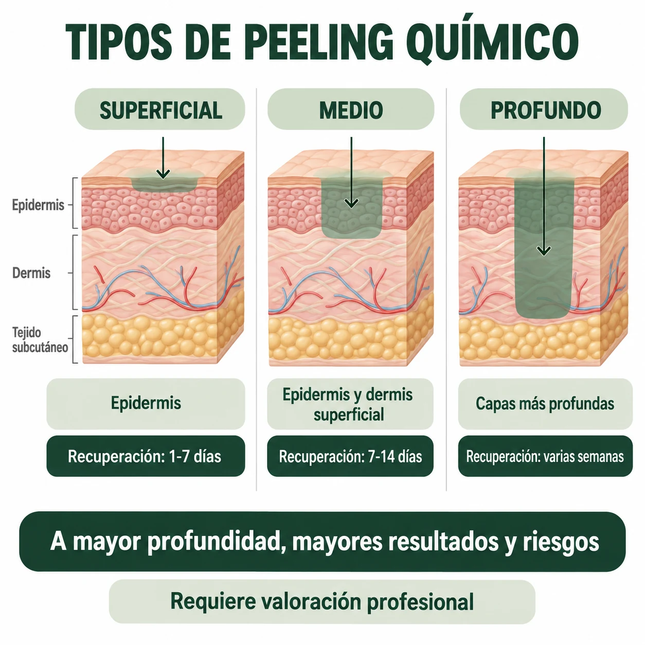 Infografía sobre peeling superficial, medio y profundo, profundidad y recuperación